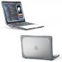 Nárazuvzdorný kryt s vyklápacími nožičkami pre MacBook Pro 13" (A2251 / A2289 / A2338) - sivý